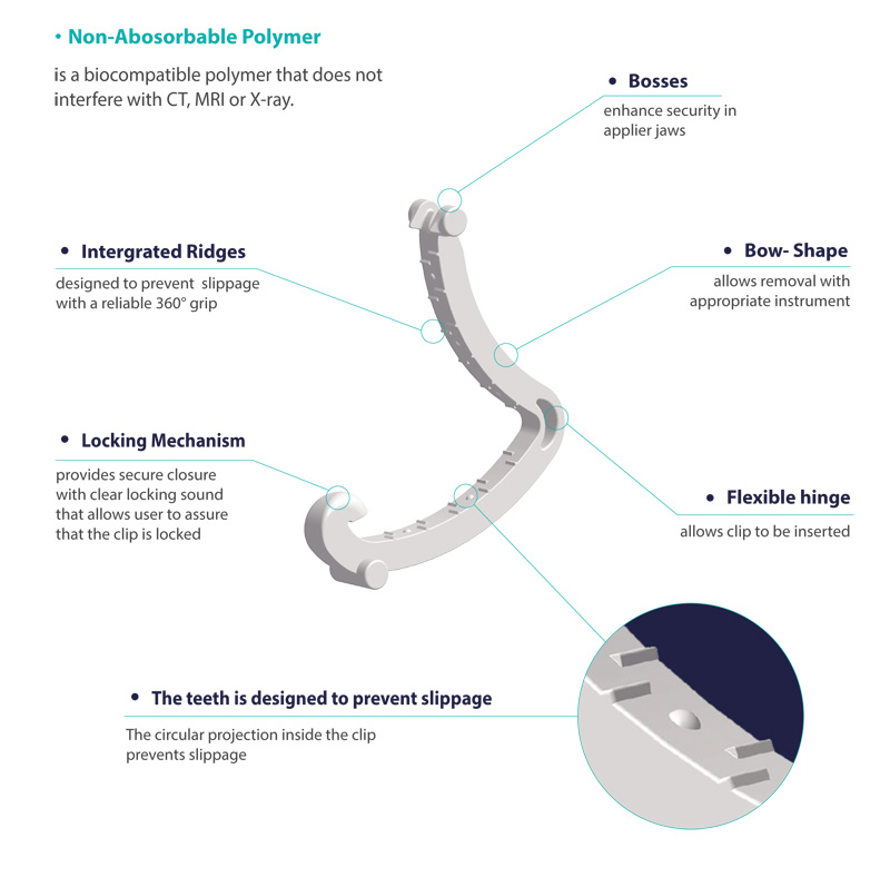 MetaClip, Meta Clip, Polymer Ligating Clips, Polymer Medical Clips, Polymer Clips, MetaClip Polymer Clips, MetaClip Medical Clips, Bangalore, MetaClip Bangalore, Meta Clip Bangalore